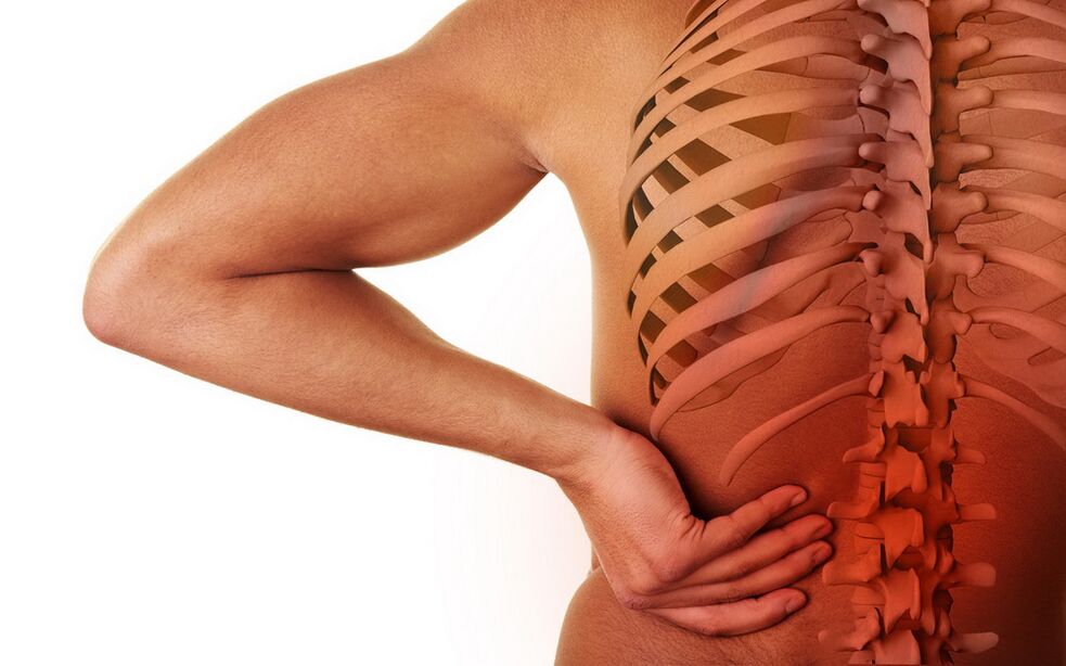 pian ar ais mar gheall ar osteochondrosis