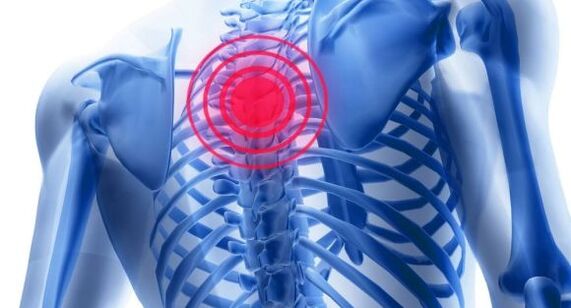 Cóireáil osteochondrosis an dromlaigh chliabhraigh
