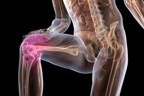 pian comhpháirteach mar gheall ar arthrosis glúine